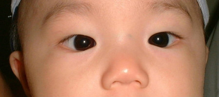 斜视怎么矫正?西安小儿斜视哪家医院好?