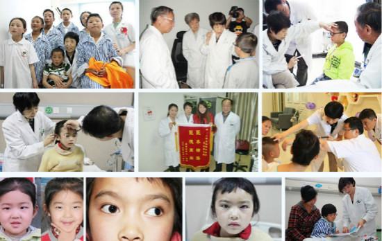 小孩斜弱视如何?