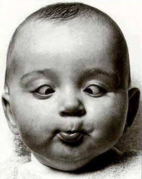 斗鸡眼怎么矫正?斗鸡眼的方法