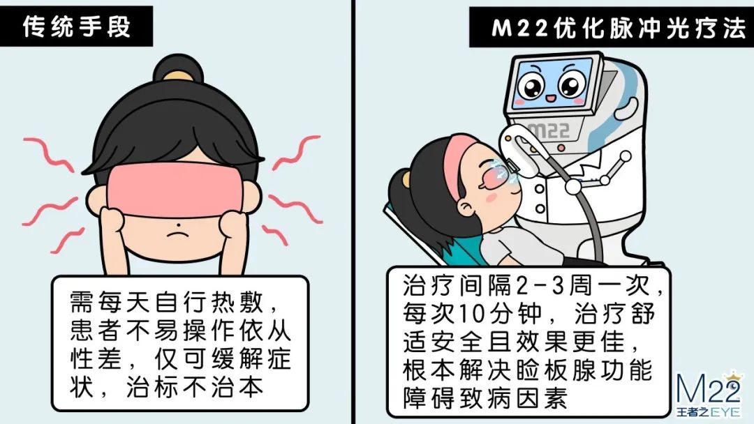 我院引进干眼仪器——M22强脉冲光